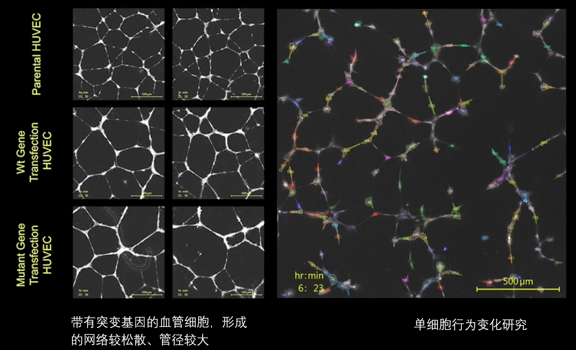 6、血管分析.png